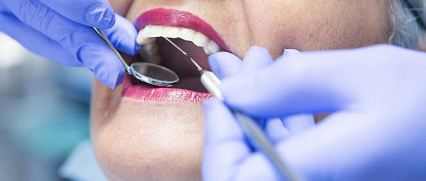 Best Dental Abscess Treatment in Pine Mountain Lake, CA